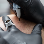 Personne en train de pratiquer la tricopigmentation pour redonner l'illusion de cheveux sur le cuir chevelu.