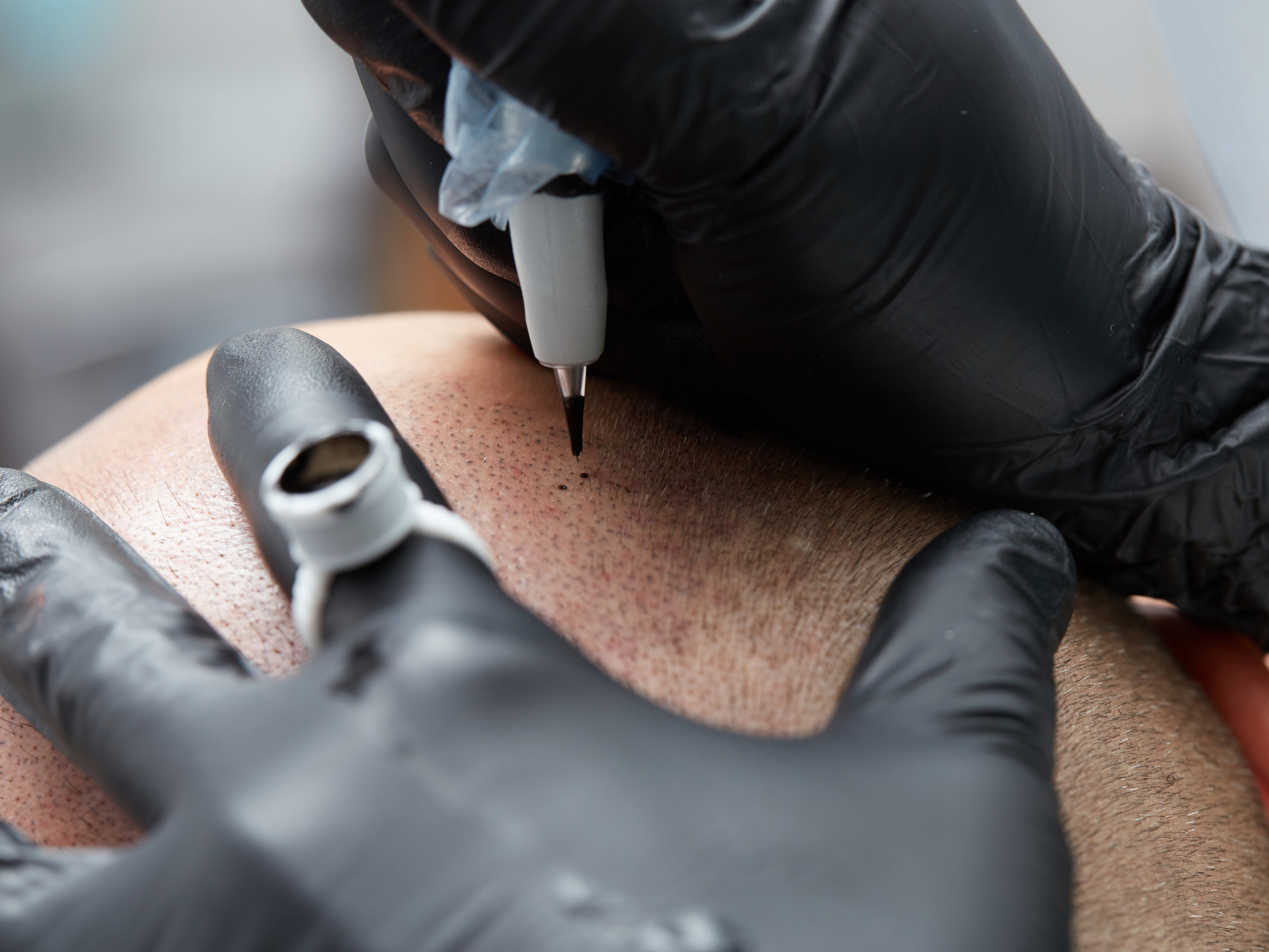 Tricopigmentation