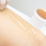 Esthéticienne en train d'épiler une cliente au caramel, selon la technique de l'épilation orientale.