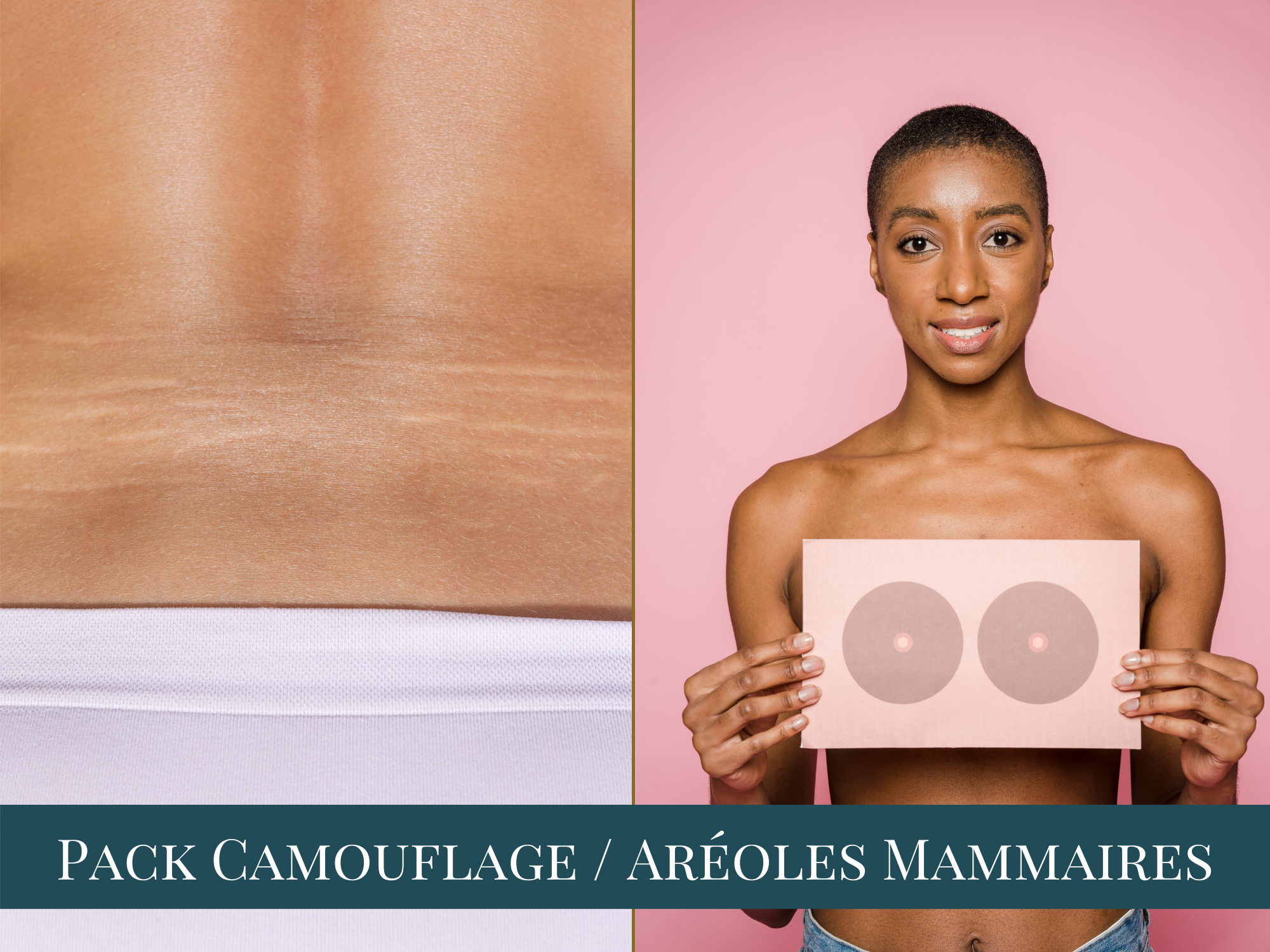 PACK Camouflage – Aréoles mammaires